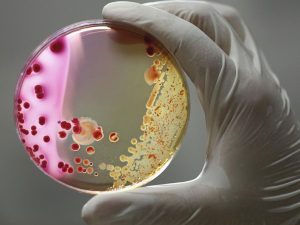 تفاوت محیط کشت سلولی و میکروبی