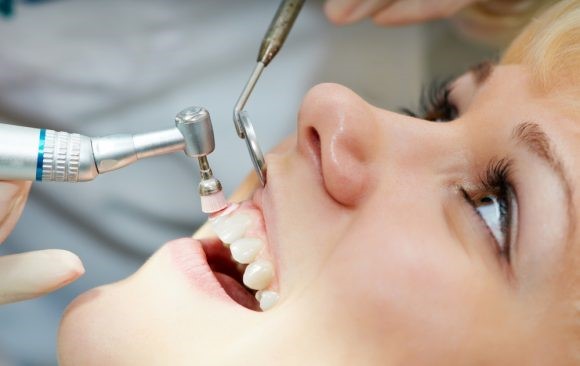 نگاهی بر روش های مختلف سفید کردن دندان