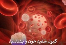 گلبول سفید خون را بشناسید