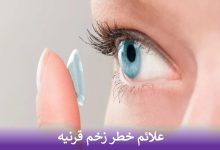 علائم خطر زخم قرنیه