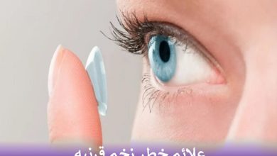 علائم خطر زخم قرنیه